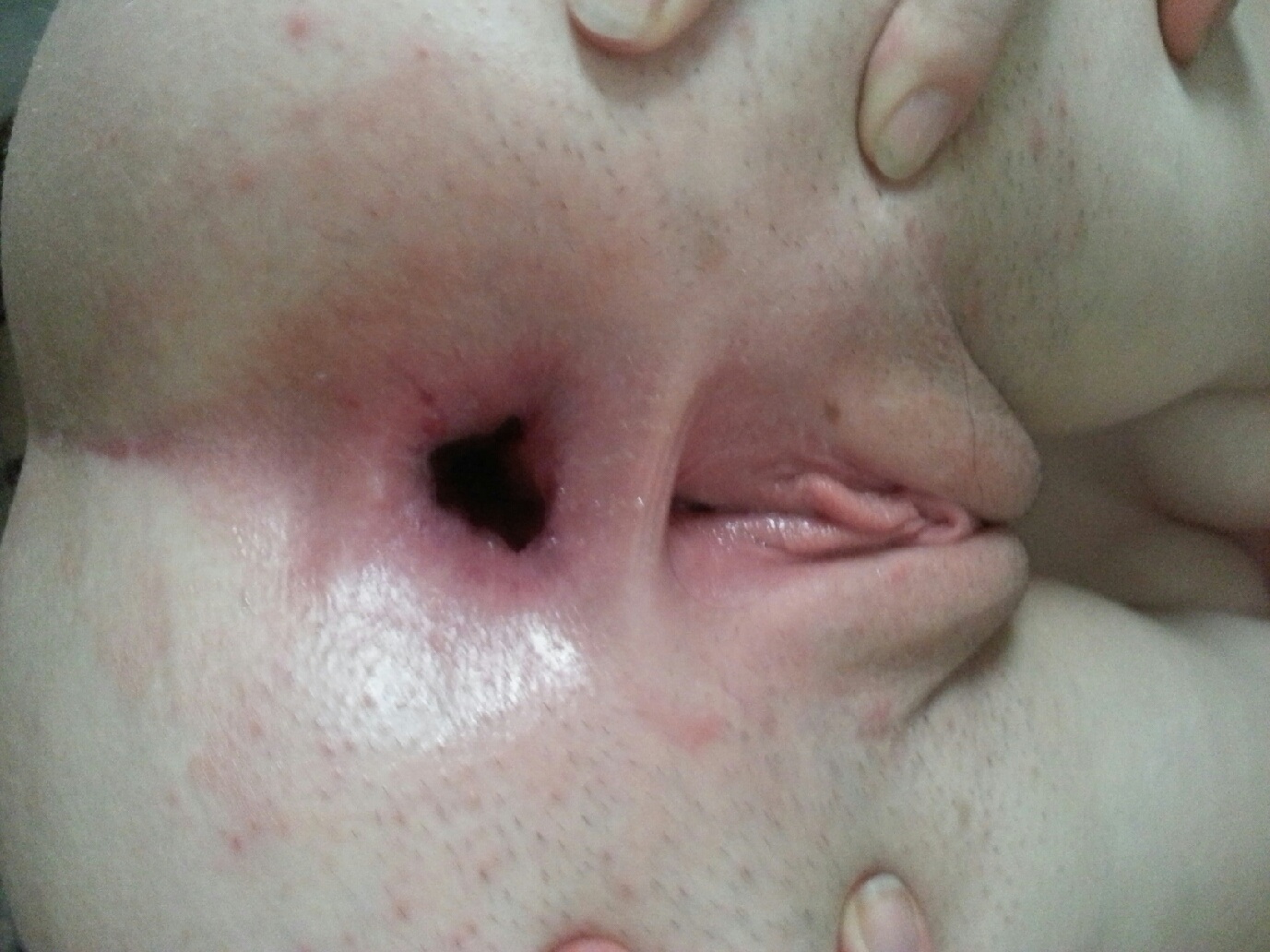 cire nat recommends amateur gape pic