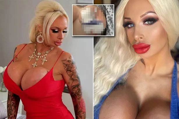 dana badiu add photo plastic surgery porn