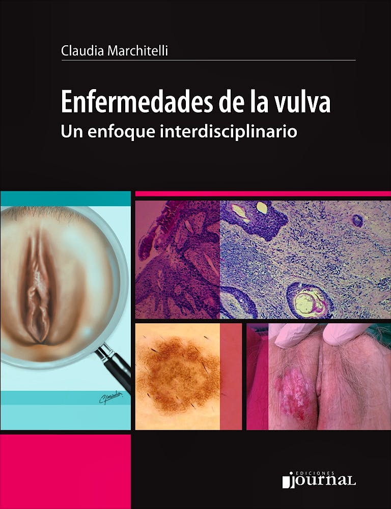 cheryl christenson recommends veronica vulva pic