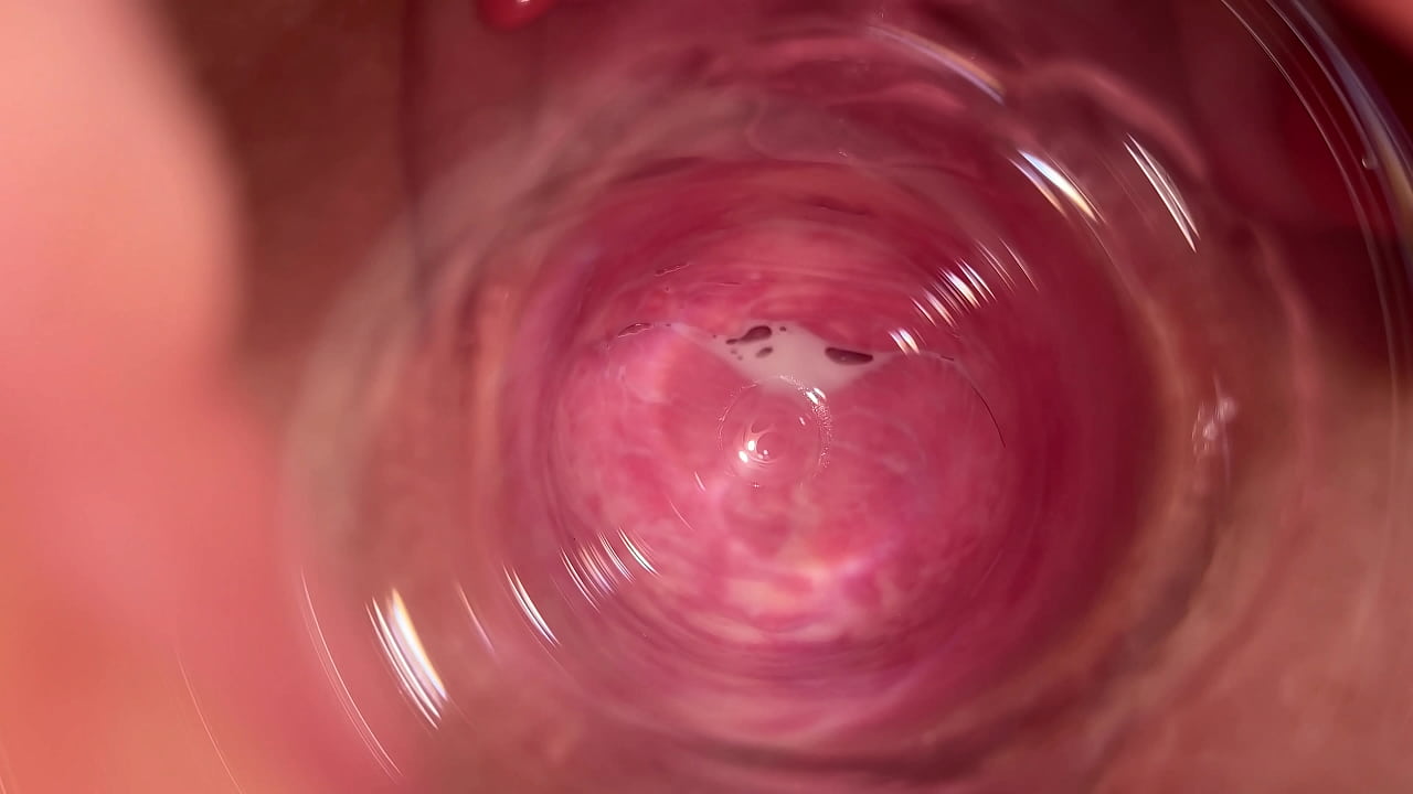 anna marie myers recommends internal vagina camera pic