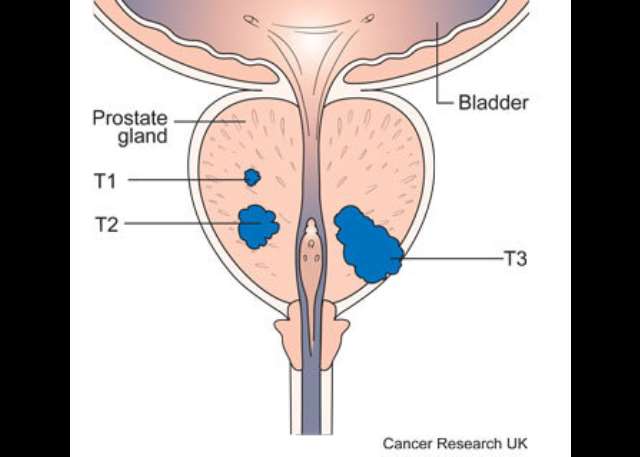 brandon latham recommends prostate stimulation stories pic