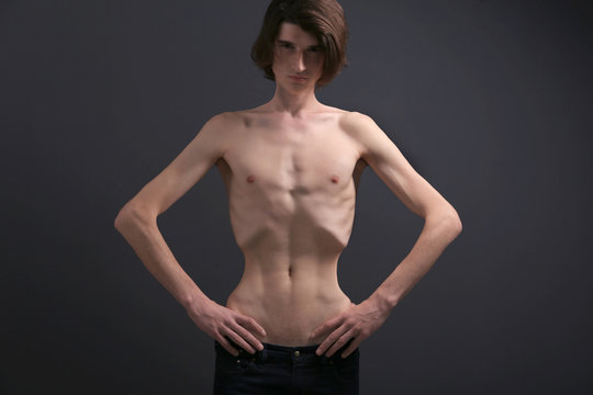 crystal rosamond recommends Anorexic Twinks