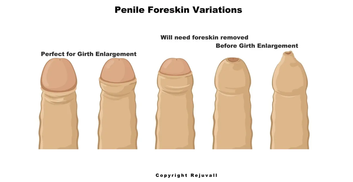 asabur rahman recommends men comparing penises pic