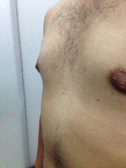 ahmed afroto recommends Small Puffy Nipple