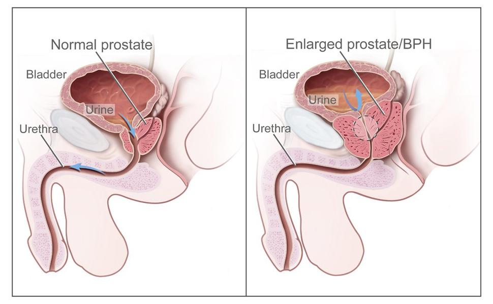 Best of Cum during prostate exam