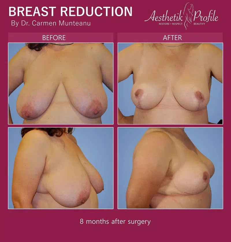 amanda ponusky recommends Puffy Breast Video