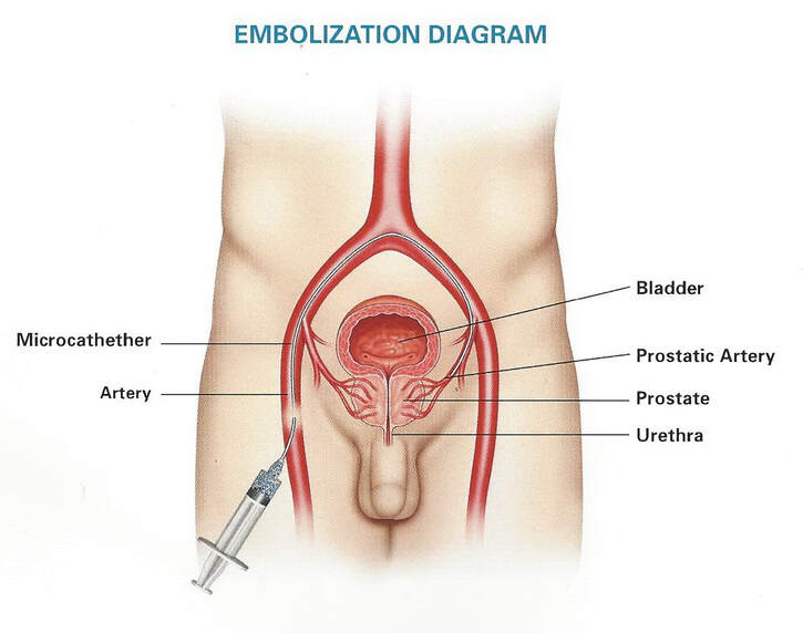 cum during prostate exam