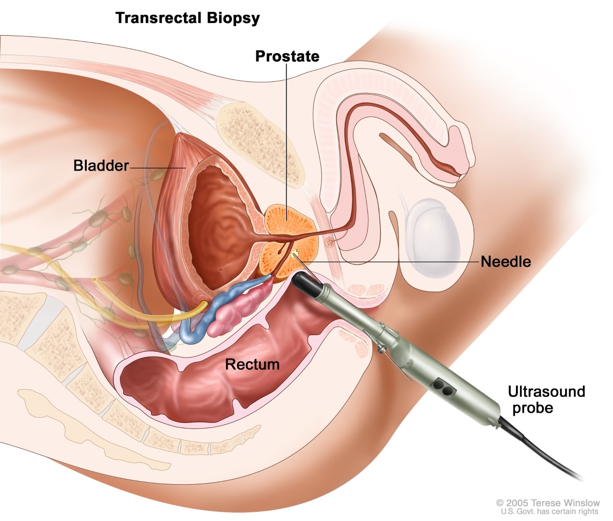 chas henry recommends Cum During Prostate Exam