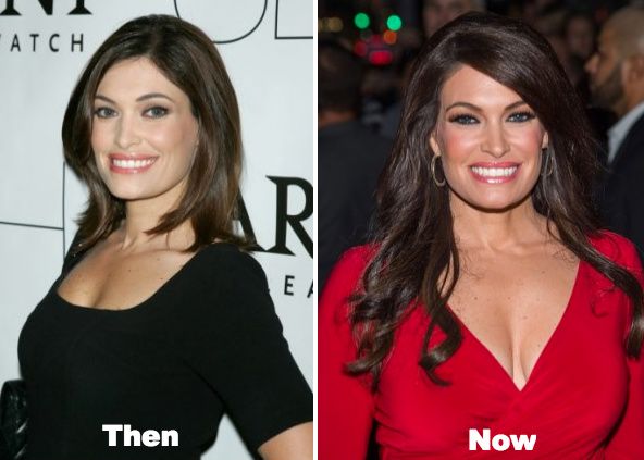 ahmed husen share kimberly guilfoyle tits photos