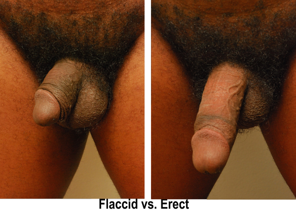 delores duncan recommends erect nudes pic