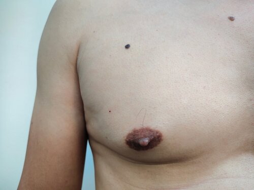 carlos puche add photo fat black nipple