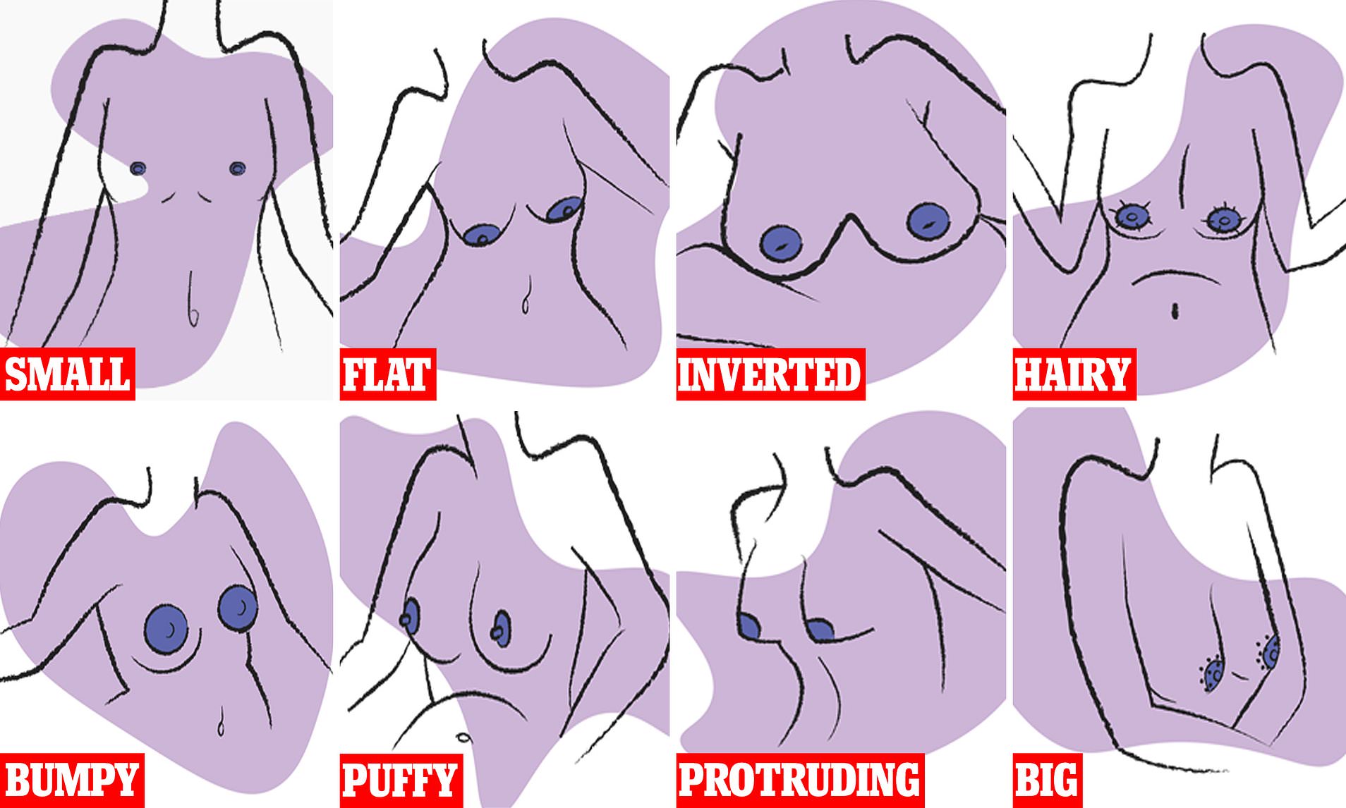 ben lemire recommends huge puffy breasts pic