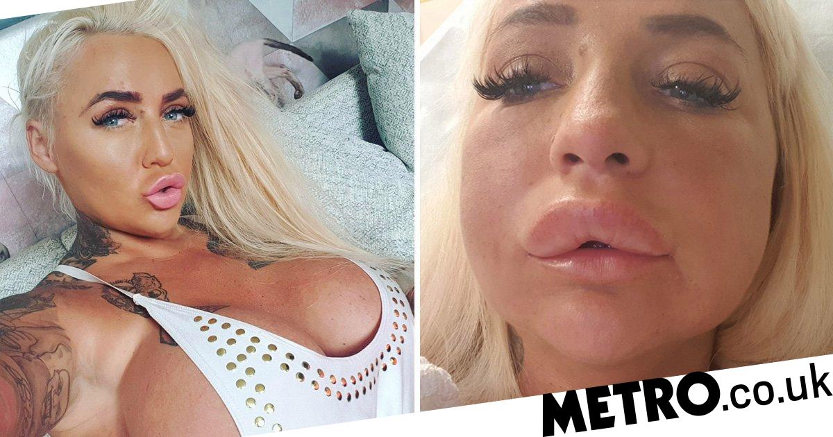 dee dungee share plastic surgery porn photos