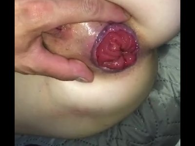 cassandra garrison recommends prolapse squirt pic